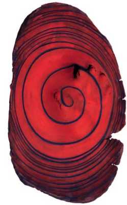 Pushing Forward Back